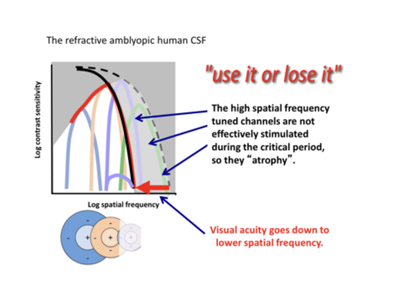 <p>Will VA decrease in amblyopia d/t the loss of high spatial frequencies?</p>