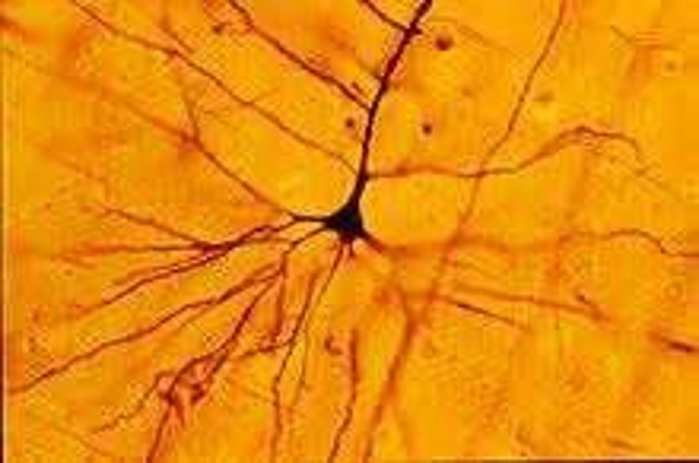 <p>Visible with Golgi stain, not Nissl.</p>
