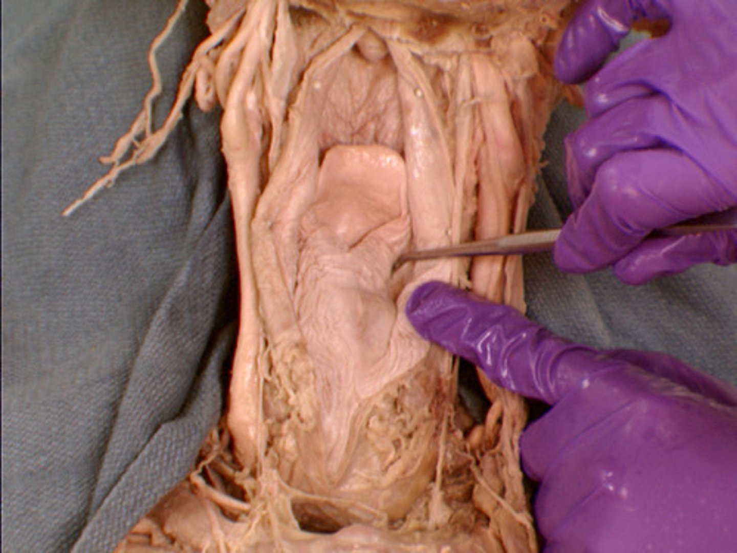 <p>hollow pockets on the lateral sides of the glottic opening</p>