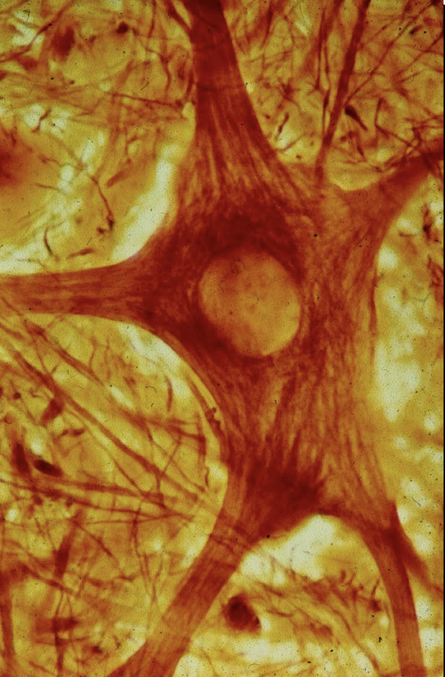 <p>cyto-squelette très dévéloppé</p><p>-neurofilaments: maintient de la forme</p><p>-microtubules: role essentiel dans le transport axonal</p>