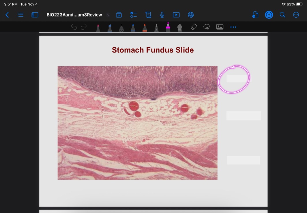 <p>What is this layer?</p>