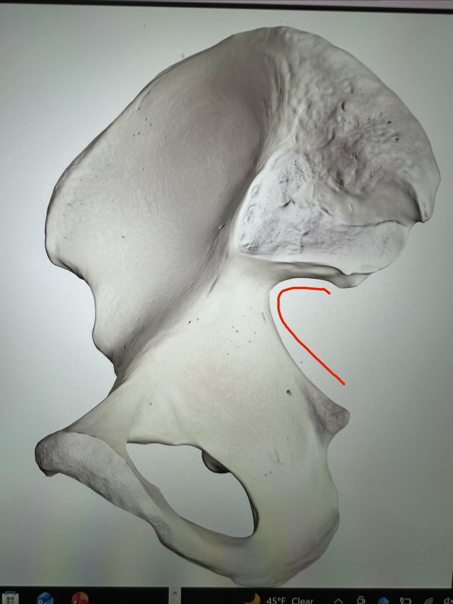 <p>os coxae, wide notch just below posterior inferior iliac spine</p>