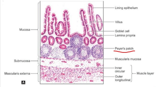 <p>Presence of Peyer’s patches in mucosa.</p>