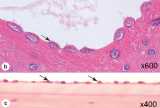 <p>what kind of epithelium is this&nbsp;</p>