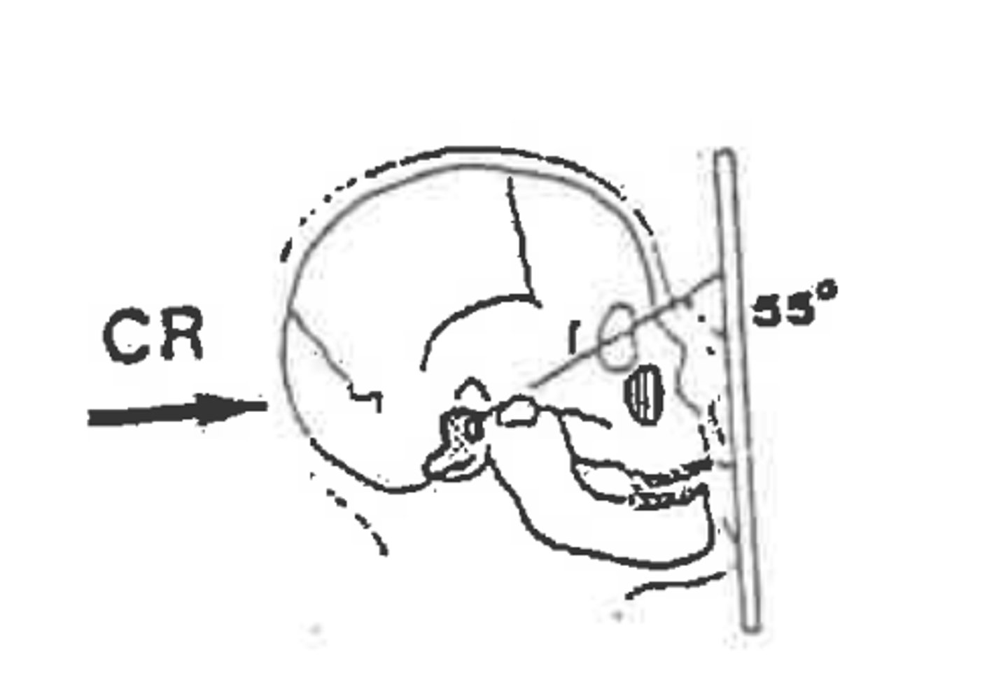 <p>Method:</p><p>Projection:</p>