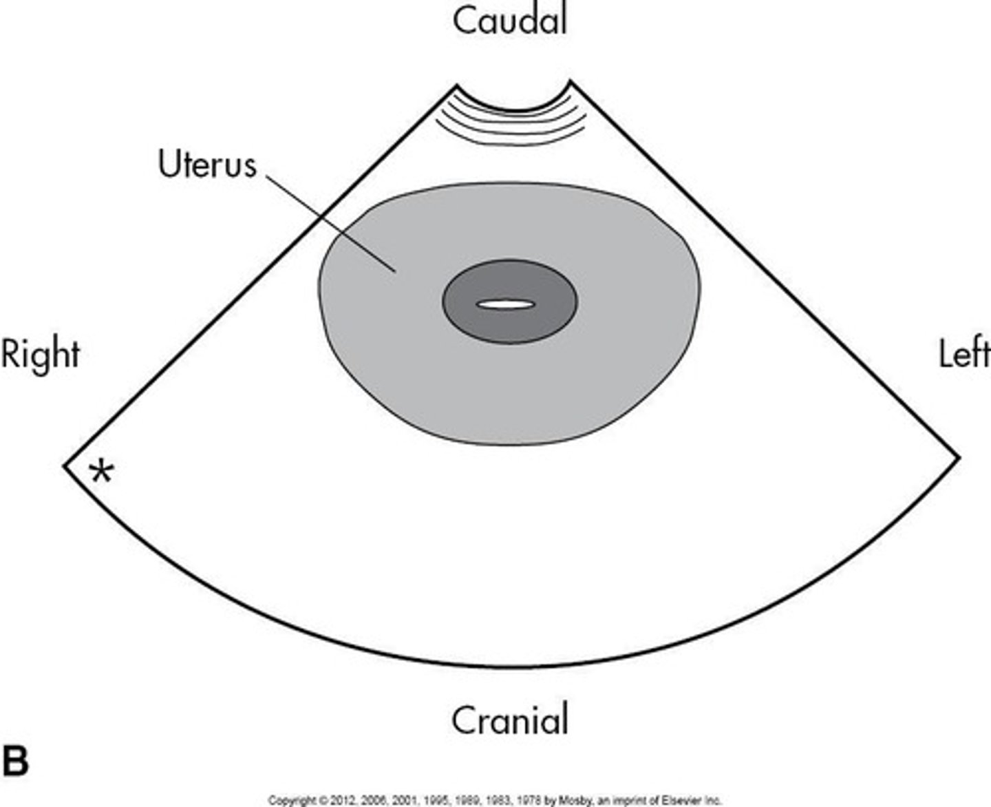 <p>Different planes used for imaging pelvic structures.</p>