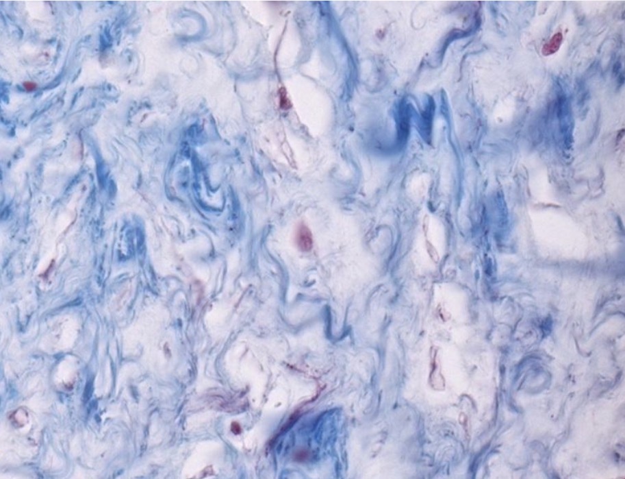 <p>Mukocitai ir tarplasteline medziaga</p>