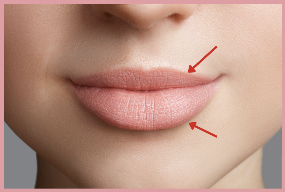 <p>This is the term of the pointed structures which marks the transition between skin and mucus membrane of the lips?</p><p>a. Oral commissure</p><p>b. Mentolabial sulcus</p><p>c. Philtral ridge</p><p>d. Vermillion border</p>