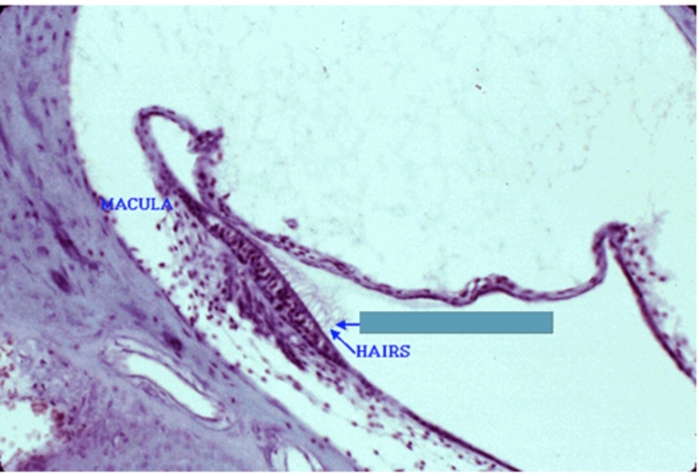 <p>Identify the following structure</p>