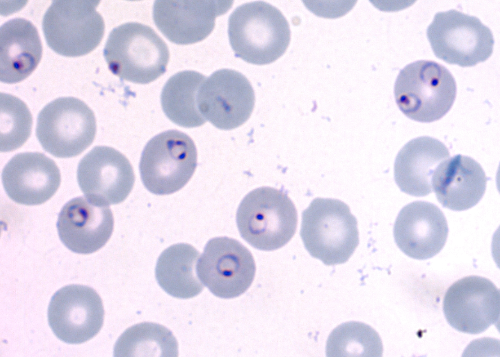 <p>Kingdom: Protista</p><p>Phylum: Apicomplex</p>