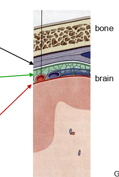<p>what is the red arrow pointing to?</p>