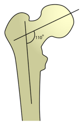 <p>&lt;120 degree</p>