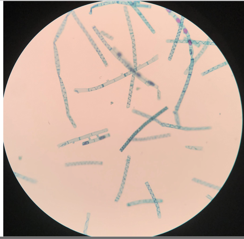 <p>Type of chlorophyte</p><p>Freshwater green algae</p><p>Reproduce via conjugation (bacterial sex) resulting in diploid zygotes</p>