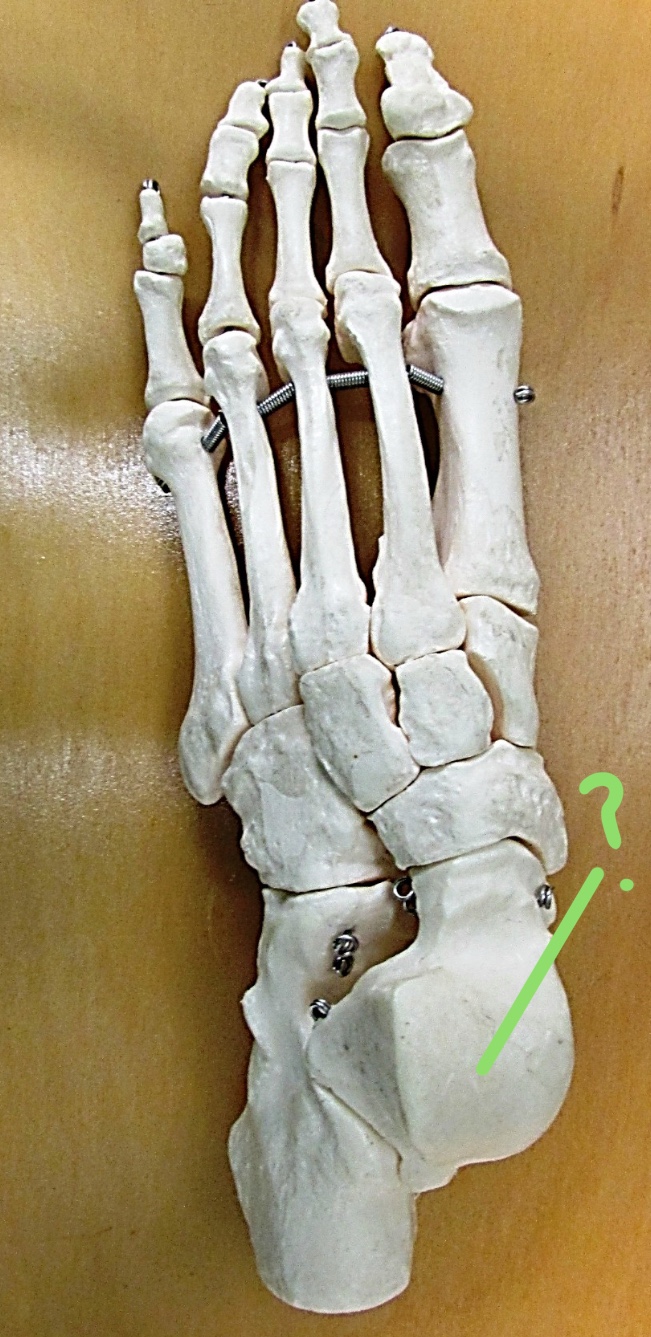 <p>Determine the part of the Femur highlighted</p>