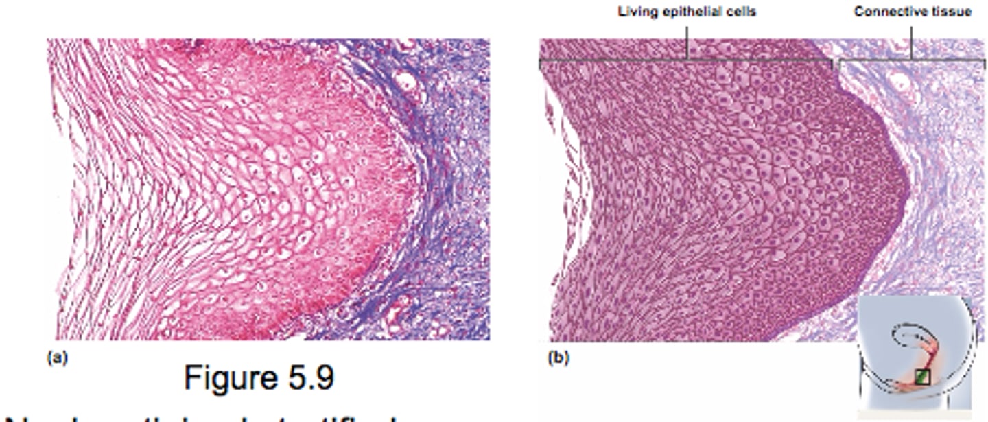 <p>internal mucousa that are protective but lack keratin</p><p>- tongue, oral mucosa, esophagus, vagina</p><p>- resists abrasion and penetration of pathogens</p>