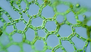 <p>frw benthic (this is the only U.S. species!)</p>