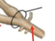 <p>the dorsal and ventral roots unite to form this, which continous out to the periphery - contain both sensory and motor information</p>