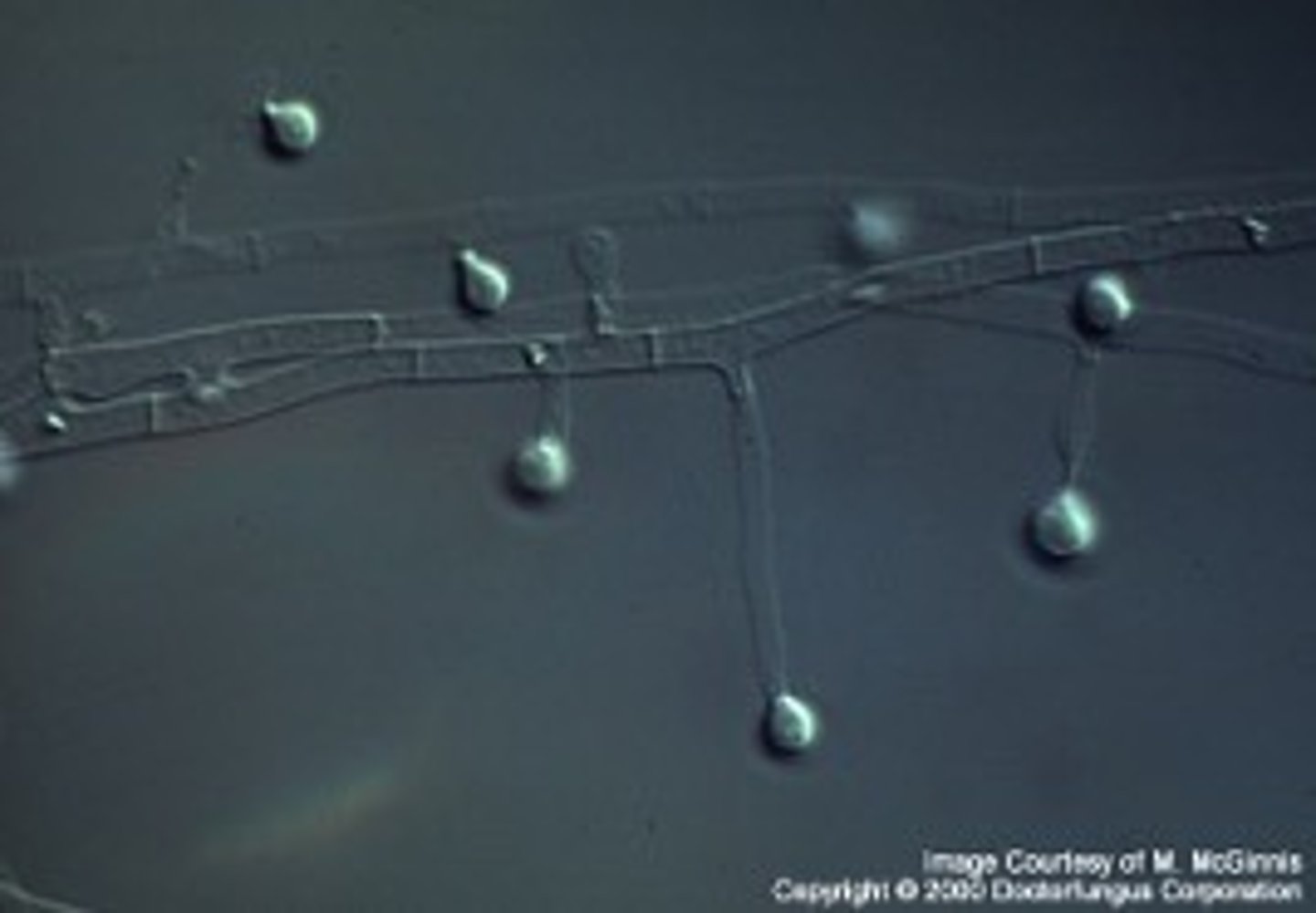 <p>(Mold form)</p>