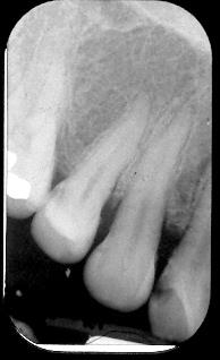 <p>What is this error?</p>