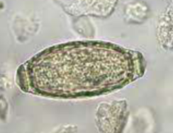 <p>usually asymptomatic, but can cause blood in urine, irritated bladder</p>