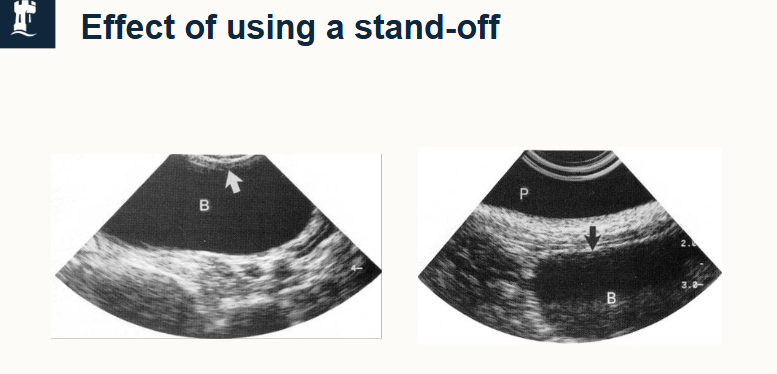 <ul><li><p>used to increase distance b/w transducer and superficial structures, moving the image down the screen to enable interpretation of near structures</p></li><li><p>adjust to uneven contours to give better contact</p></li><li><p>can be built in or pre-shaped removable pads. </p></li></ul><p></p>