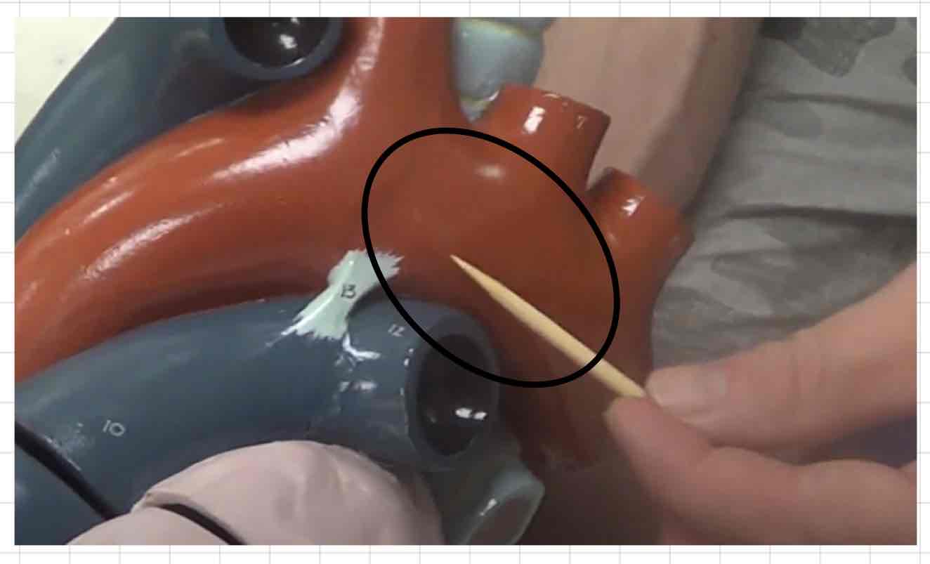 <p>what is this? (giant heart model)</p>
