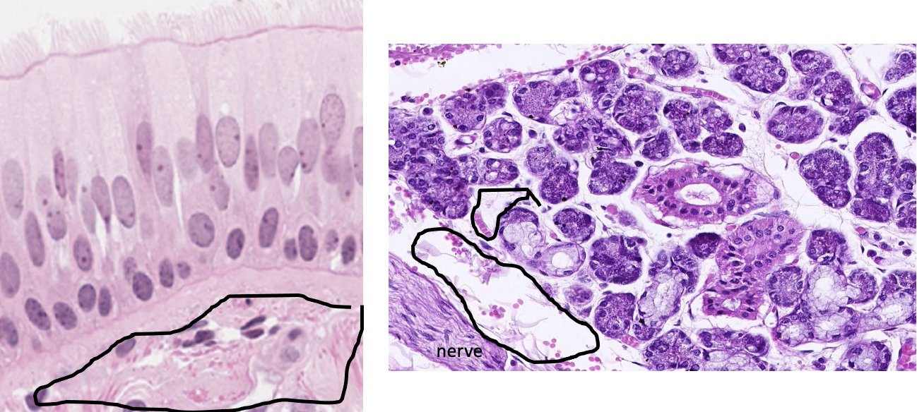 <p>What tissue is found in the black circles? basic.</p>