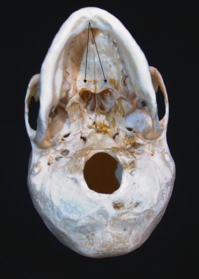 name the bone 