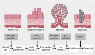<ol><li><p><span>Mutation in <mark data-color="yellow" style="background-color: yellow; color: inherit">APC gene</mark>&nbsp; → <mark data-color="blue" style="background-color: blue; color: inherit">abnormal proliferation</mark></span></p></li><li><p><span>Mutation in <em><mark data-color="yellow" style="background-color: yellow; color: inherit">K-ras gene</mark> </em>→ <mark data-color="blue" style="background-color: blue; color: inherit">abnormal growth and differentiation</mark></span></p></li><li><p><span>Mutation in <mark data-color="yellow" style="background-color: yellow; color: inherit">p53 gene</mark> → <mark data-color="blue" style="background-color: blue; color: inherit">continue cell replication despite DNA damage</mark></span></p></li><li><p><span>Mutation in <mark data-color="yellow" style="background-color: yellow; color: inherit">hMSH2</mark> → <mark data-color="blue" style="background-color: blue; color: inherit">no DNA repair</mark> resulting in chromosomal instability</span></p></li><li><p><span>Mutation in <em>DCC gene </em>→ abnormal cell growth and apoptosis</span></p></li></ol><p></p>