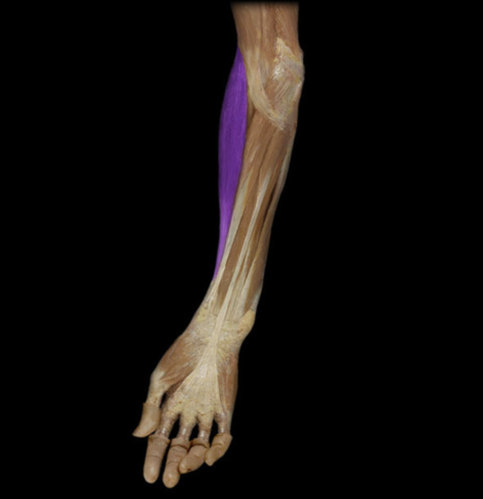 <p><em>table 3, radial n (C5-C6), elbow flexion</em></p>