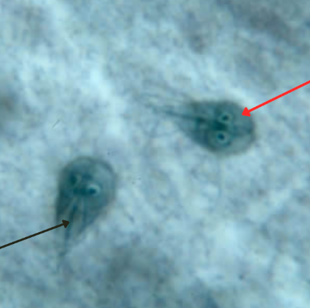 <p>What is at black arrow? (1)<br>What is at red arrow? (2)</p>