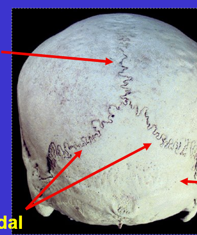<p>What suture is the bottom 2 arrows?</p>