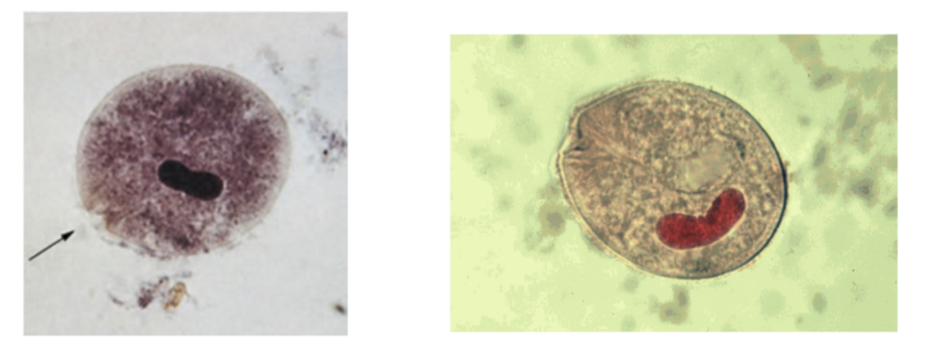 <p><strong><em>Balantidium coli —</em></strong></p><ul><li><p>What phylum does it belong to?</p></li><li><p>What is it’s method of motility?</p></li><li><p>What disease does it cause?&nbsp;</p></li></ul><p></p>