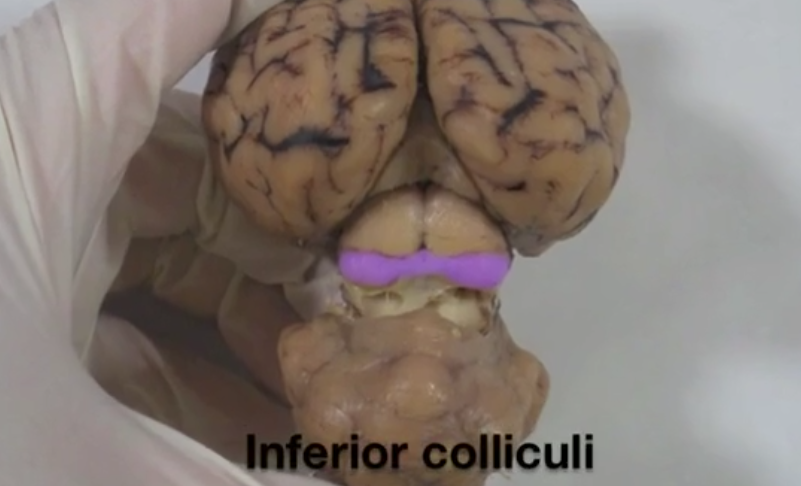 <p>Inferior colliculi</p>