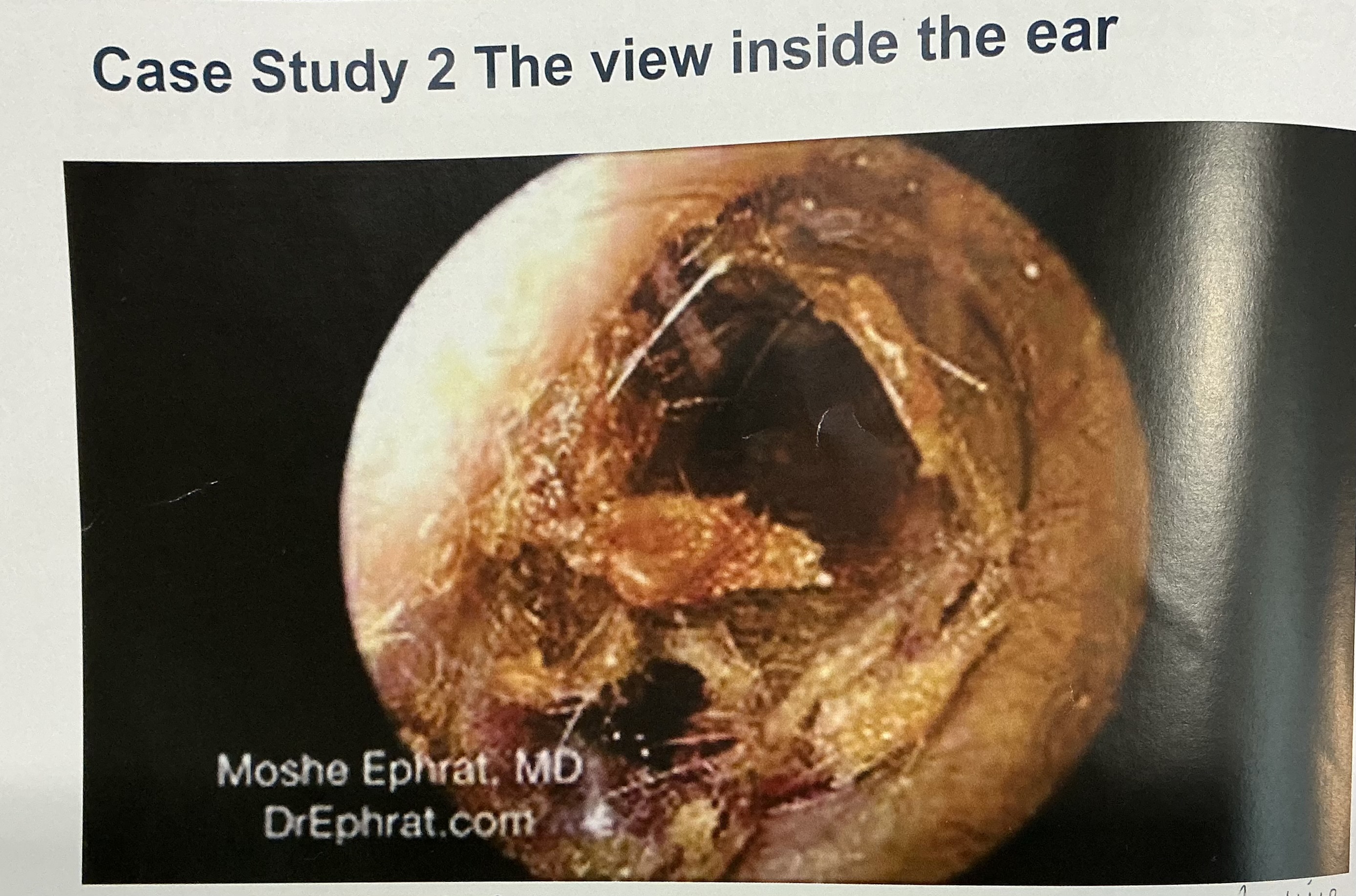 <p><u>Case Study 2</u></p><ul><li><p><span><span>Three weeks ago David Bolton arranged to see the pharmacist for a Medicines Review as he has been on his hypertension medicines, isosorbide mononitrate, indapamide, nifedipine and Glytrin for many years.</span></span></p></li><li><p><span><span>﻿﻿The pharmacy assistant has asked David to wait to the pharmacy consultation room.</span></span></p></li><li><p><span><span>﻿﻿Elaine, the pharmacy assistant, explains to you that David is anxious to ask you some questions about their ears as they have been having some problems since they returned from their holiday in Spain.</span></span></p></li><li><p><span><span>﻿﻿Review the scenario</span></span></p></li></ul><p></p>