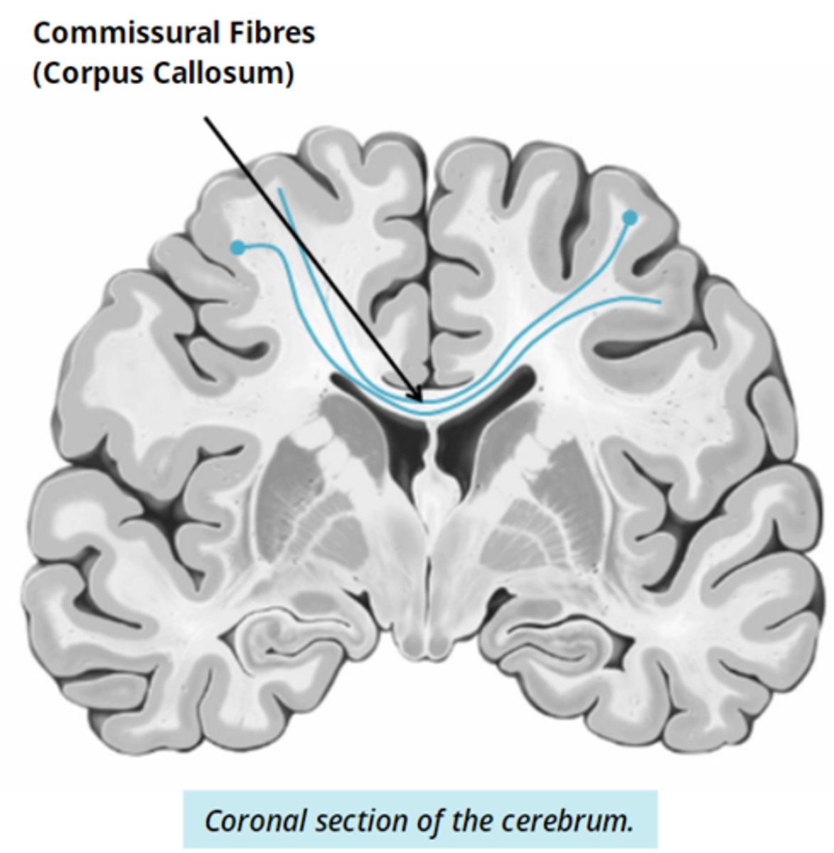 <p>- communication between the 2 hemispheres </p><p>-ex. corpus callosum</p>
