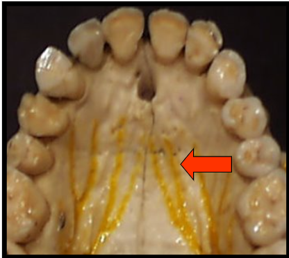 <p><span>The bony wall that separates the nasal cavity from the oral cavity.</span></p>