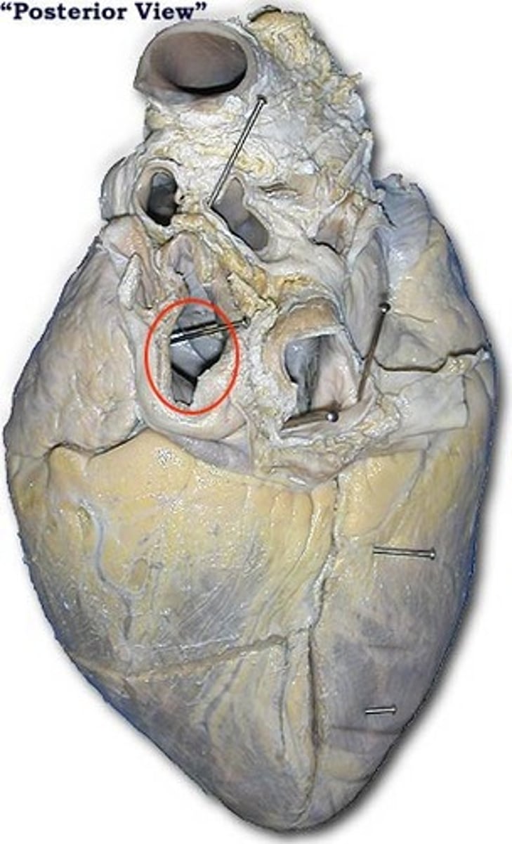 <p>Identify the blood vessel.</p>