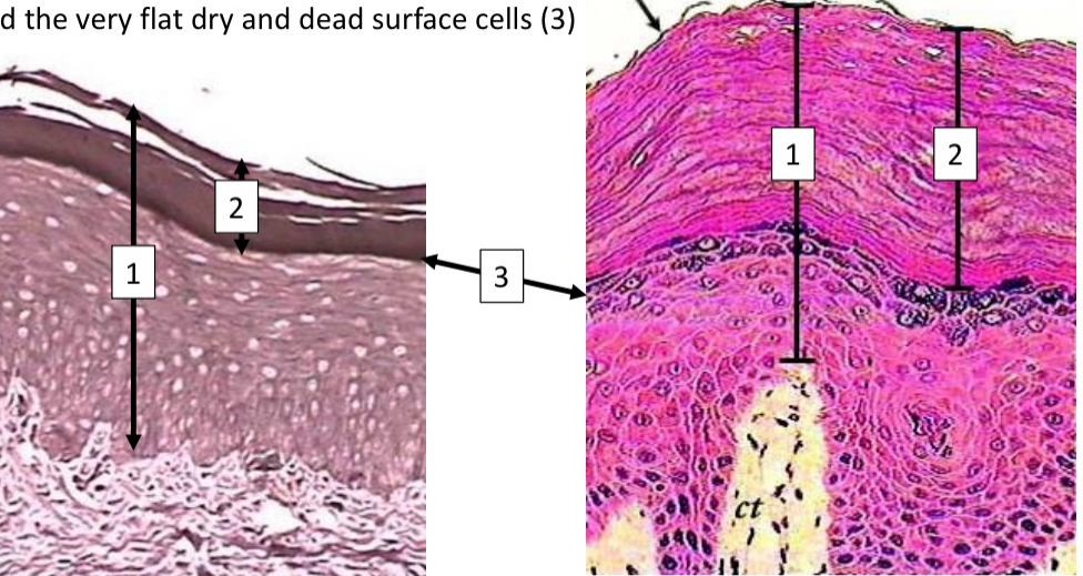 <ul><li><p>Squamous cell</p></li><li><p>Skin</p></li></ul><p></p>
