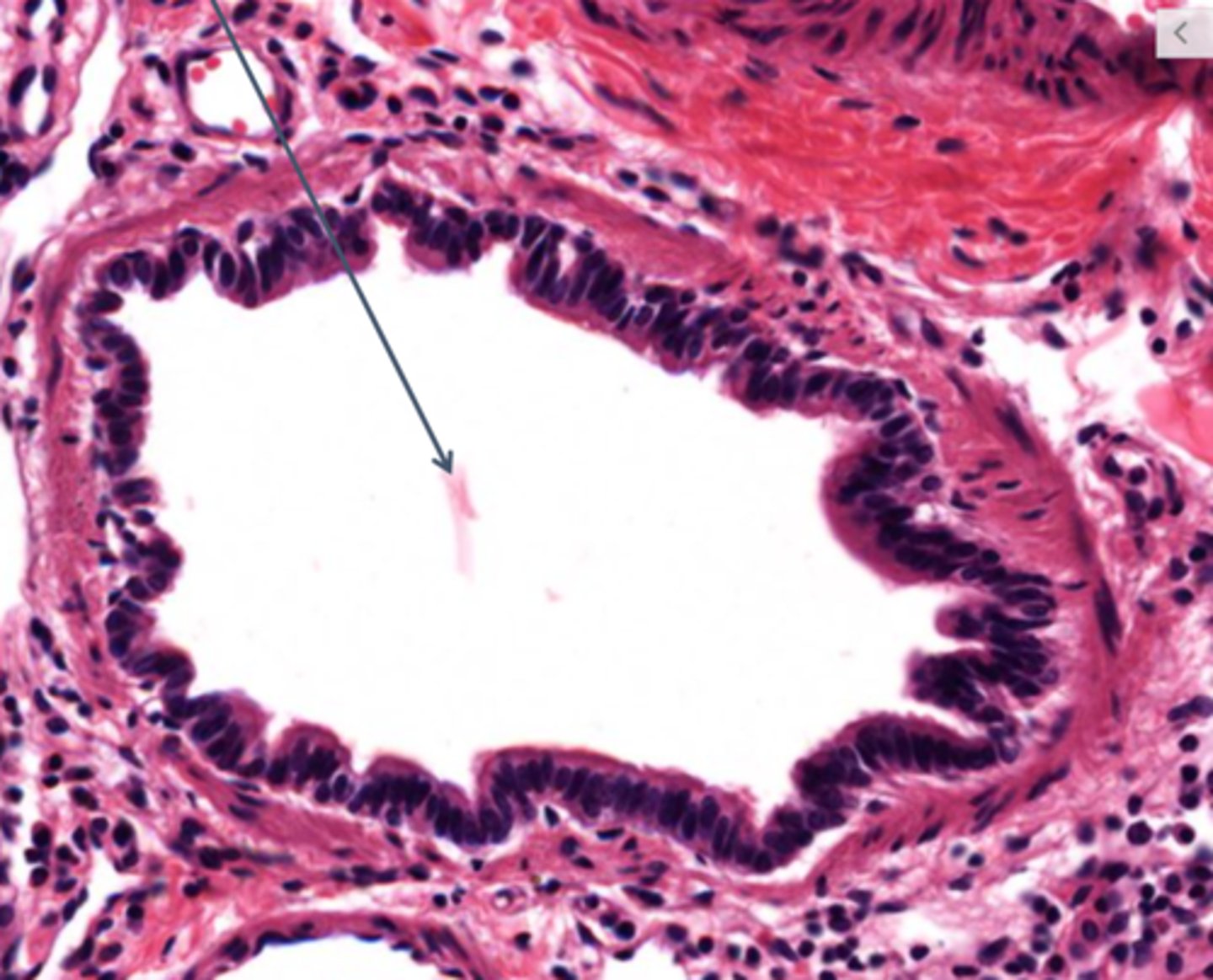 <p>Identify this type of airway</p>