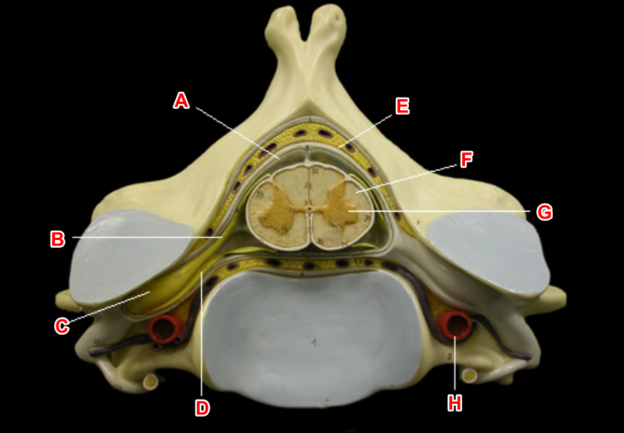 <p>using the spinal cord cross-section, define label H</p><p></p><p>wordbank: arachnoid mater, dorsal root, dorsal root ganglion, dura mater, white matter, grey matter, ventral root, vertebral artery</p>