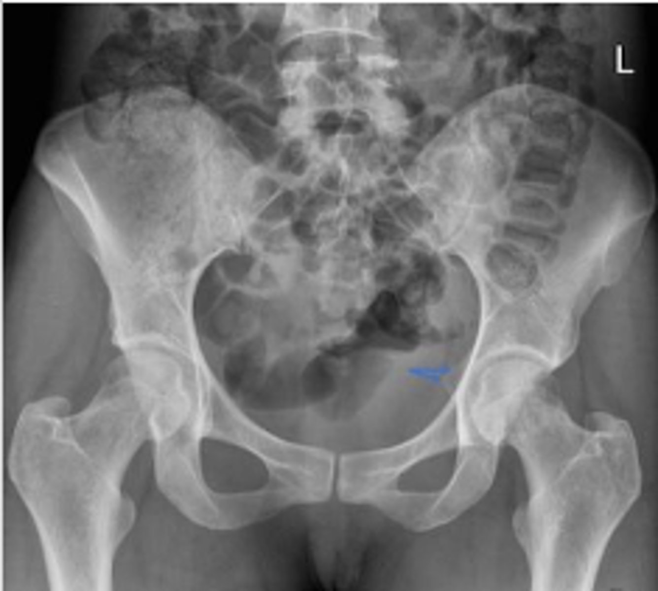 <p>What are the arrows pointing to?</p>