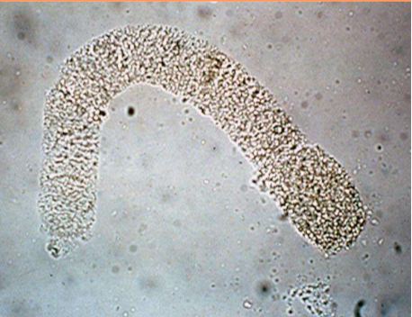<p>What type of cast is pictured?</p>