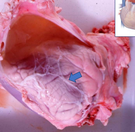 <p>What is the blue arrow pointing to?</p>