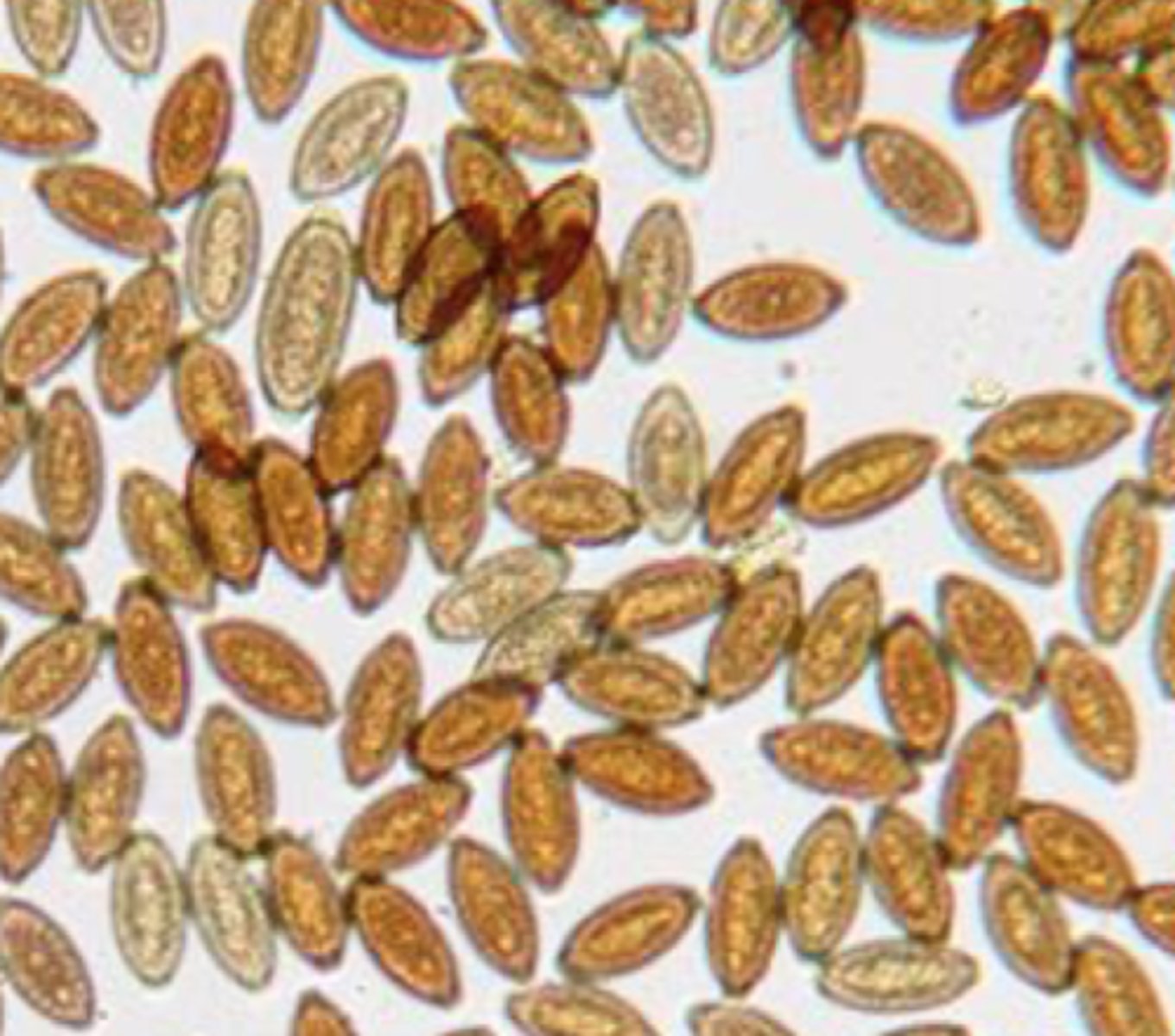 <p>What is the scientific name of these eggs found on this fecal float?</p>