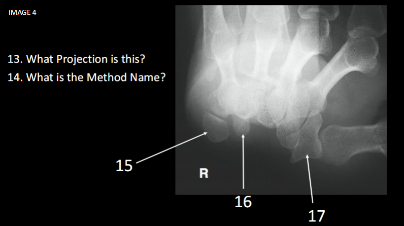 <p>What is the method name</p>