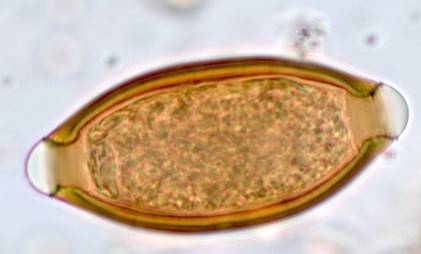 <ul><li><p>Short, fat posterior ends; long whip-like anterior end</p></li><li><p>Beaded esophagus (stichocyte)</p></li><li><p>Usually have a direct life cycle</p></li><li><p>Example of <em>Trichuris</em> egg pictured </p></li></ul><p></p>