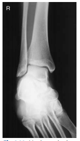 <p>What ankle view is this?</p>