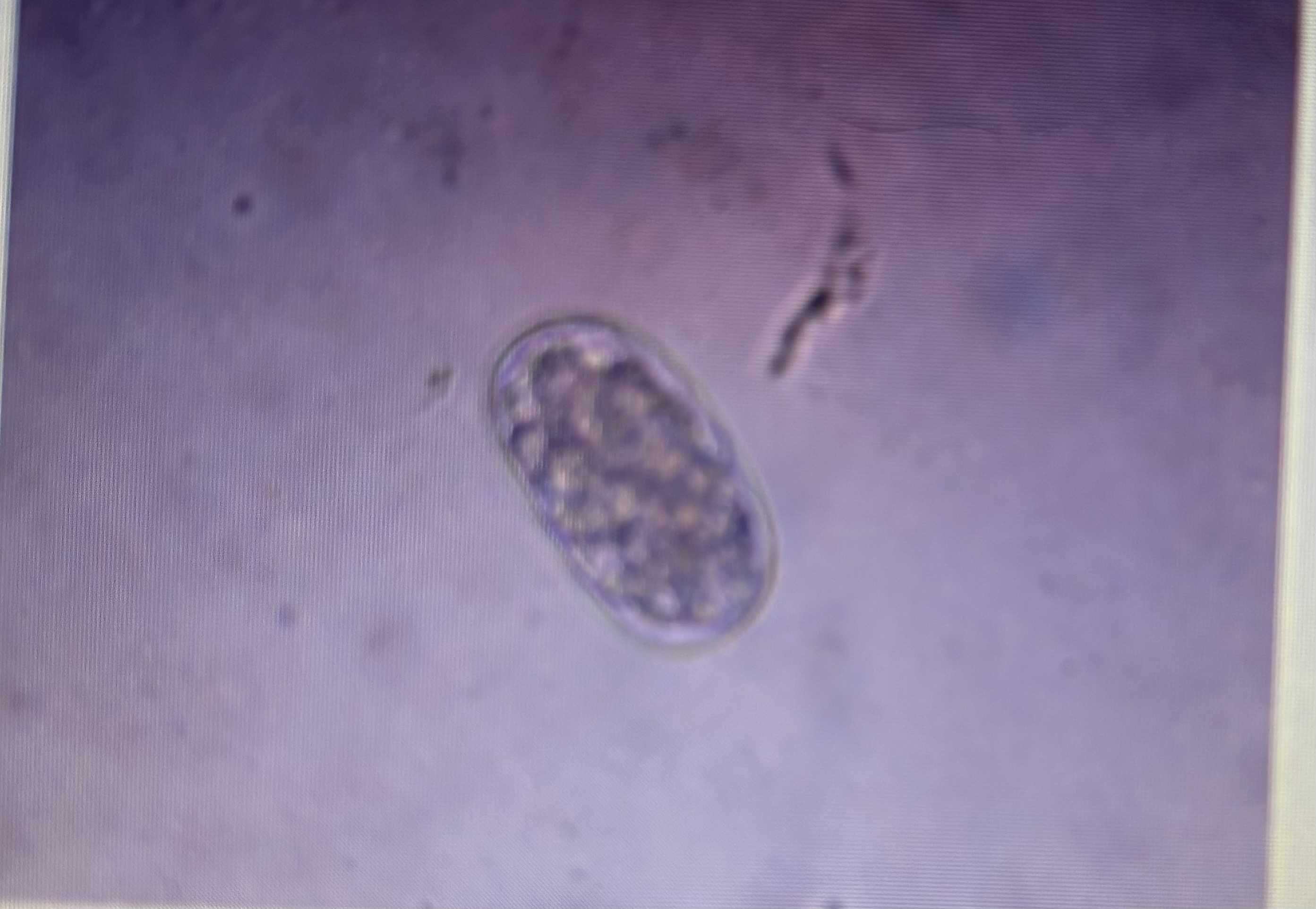 <p>Strongyloidea </p><p>Feline hookworm </p><p>Host species: cat </p><p>Size : 55-75 um x 34.4-44.7 um </p><p>Prepatent period: 14-21 days </p><p>Transmission: ingestion percutaneous </p>