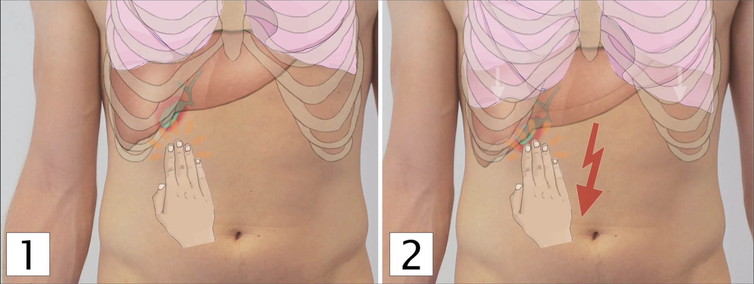 <p>A. Gallbladder (Gallenblase)</p>